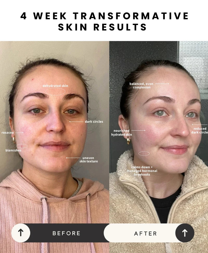 LED Glow Mask Pro – Light Therapy for Clear, Radiant Skin