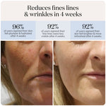 LED Glow Mask Pro – Light Therapy for Clear, Radiant Skin - Image 7