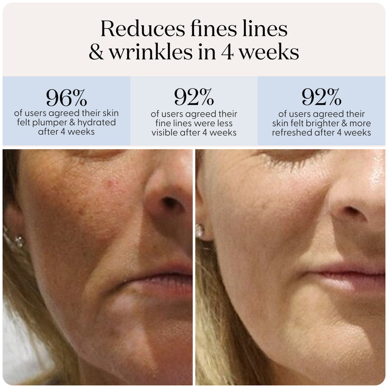 LED Glow Mask Pro – Light Therapy for Clear, Radiant Skin